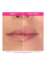 LIP LUGGAGE 2.0 SET